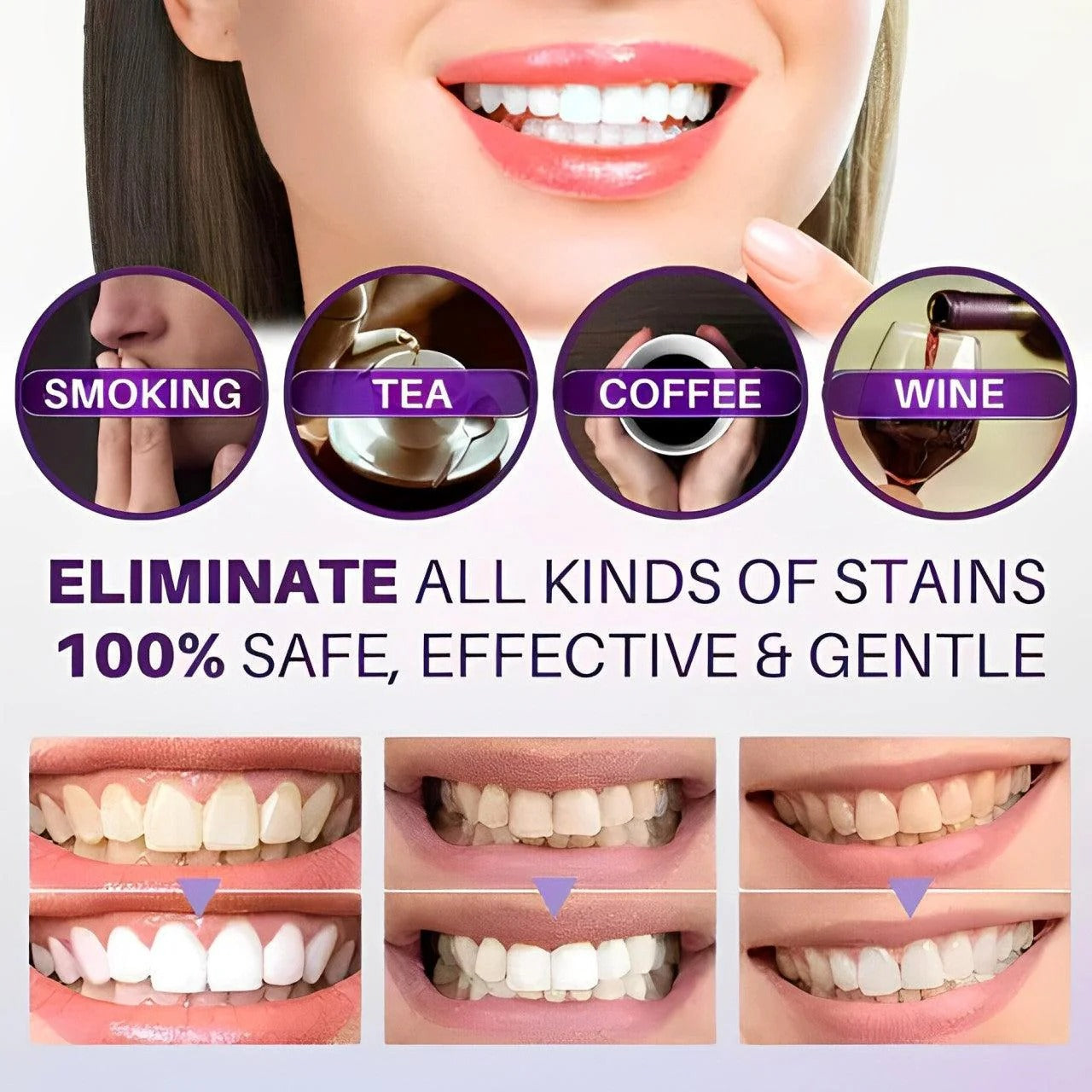 Original Hismile ( Free Home Delivery )